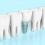 Implant dentar de calitate la Clinica Dental Premier din Bucuresti